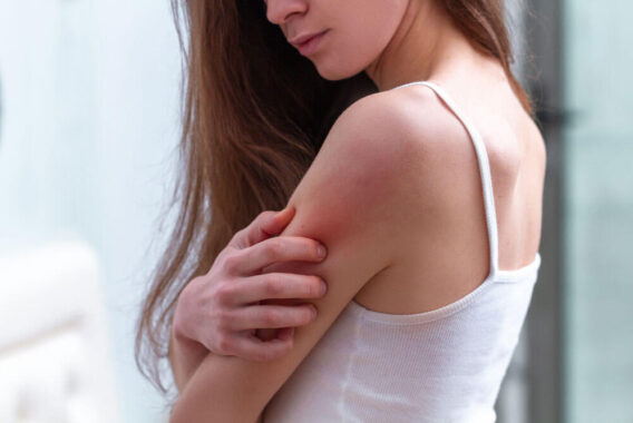 Treating Rashes: When to See a Doctor