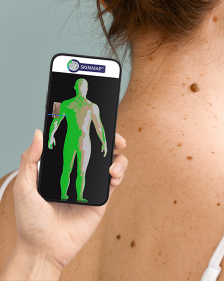 SkinMap Total Body Photography