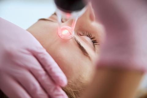 Fraxel® Laser Treatment