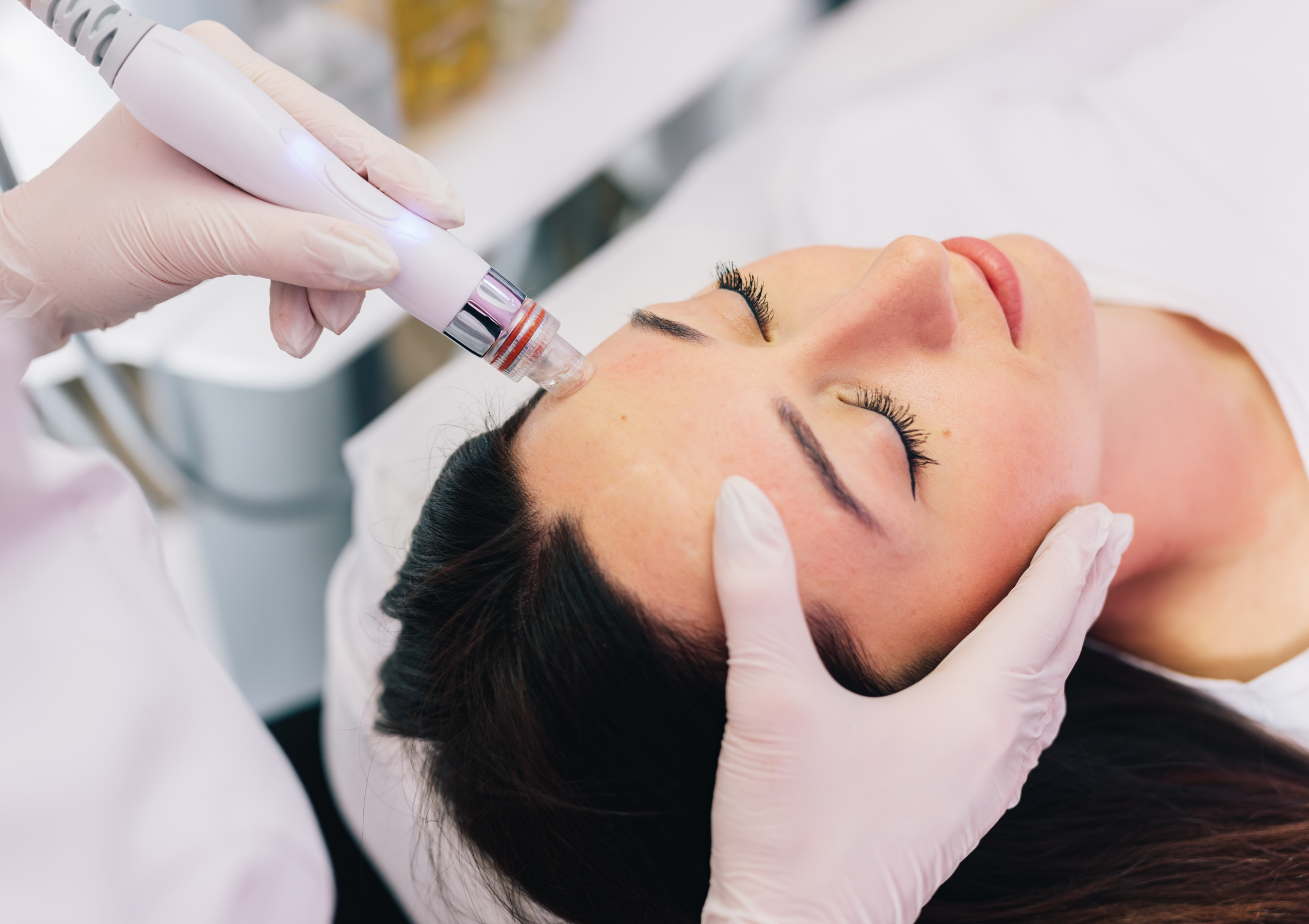 Clinician in gloves uses a handheld device on a patient’s cheek during a cosmetic facial treatment.